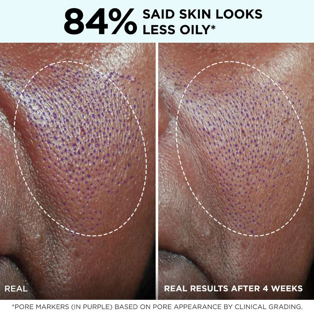 Confidence in a Gel Cream Oil-Free Moisturizer